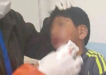 Drama en El Alto: menor sufre graves lesiones durante protestas en San Roque